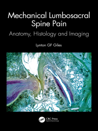Cover image: Mechanical Lumbosacral Spine Pain 1st edition 9781032326436