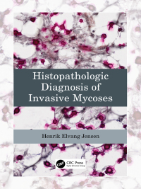صورة الغلاف: Histopathologic Diagnosis of Invasive Mycoses 1st edition 9781032306711