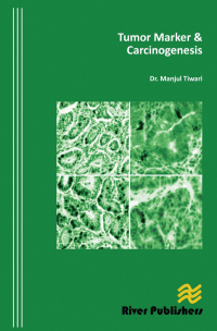 Cover image: Tumor Marker and Carcinogenesis 1st edition 9788792329370