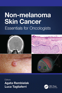 Titelbild: Non-melanoma Skin Cancer 1st edition 9781032103716