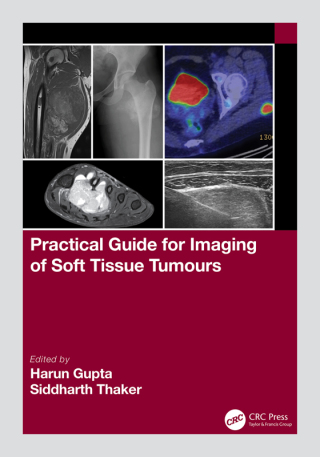Cover image: Practical Guide for Imaging of Soft Tissue Tumours 1st edition 9781032111766