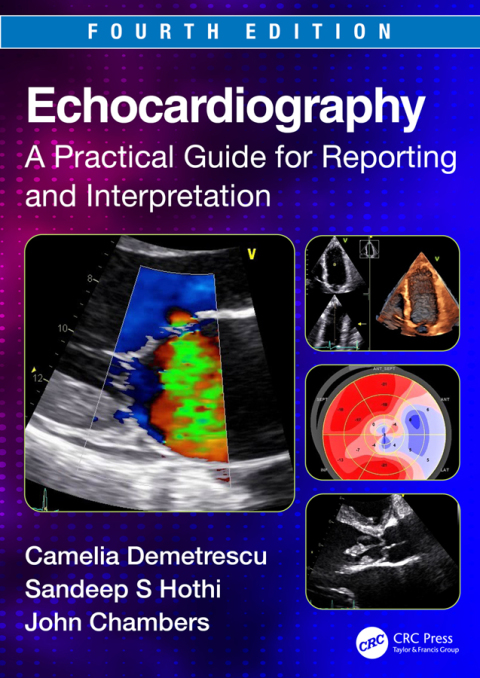 Echocardiography: A Practical Guide for Reporting and Interpretation, 4th Edition - FULL INSTANT DOWNLOAD | PDF DOCX EPUB