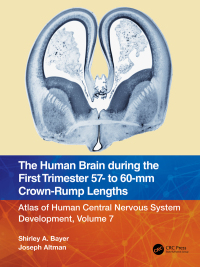Titelbild: The Human Brain during the First Trimester 57- to 60-mm Crown-Rump Lengths 1st edition 9781032185668
