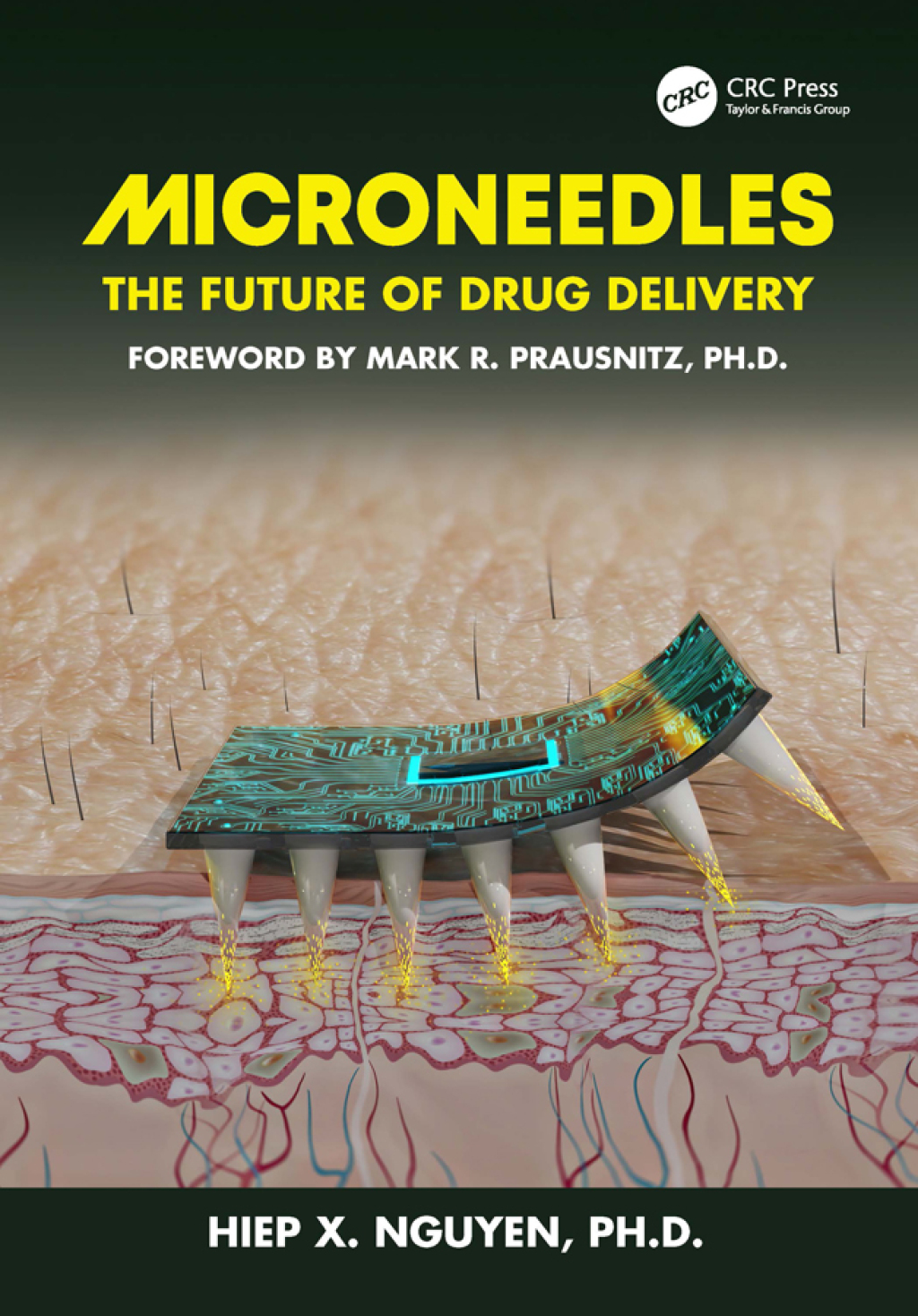 Microneedles The Future of Drug Delivery 1st Edition