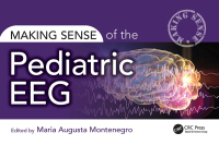 Imagen de portada: Making Sense of the Pediatric EEG 1st edition 9781032486093