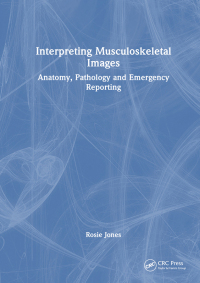 Cover image: Interpreting Musculoskeletal Images 1st edition 9781032398914