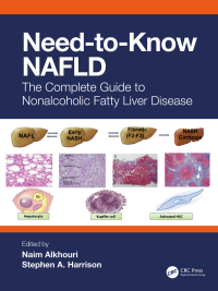 Titelbild: Need-to-Know NAFLD 1st edition 9781032479491