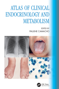 Cover image: Atlas of Clinical Endocrinology and Metabolism 1st edition 9780367608354