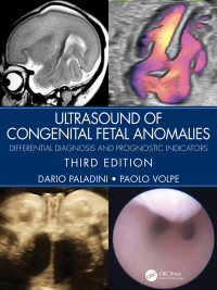 Cover image: Ultrasound of Congenital Fetal Anomalies 3rd edition 9781032752891