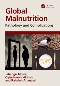 Imagen de portada: Global Malnutrition 1st edition 9781032295343