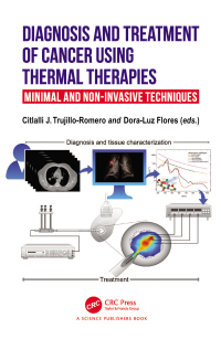 Immagine di copertina: Diagnosis and Treatment of Cancer using Thermal Therapies 1st edition 9781032379364