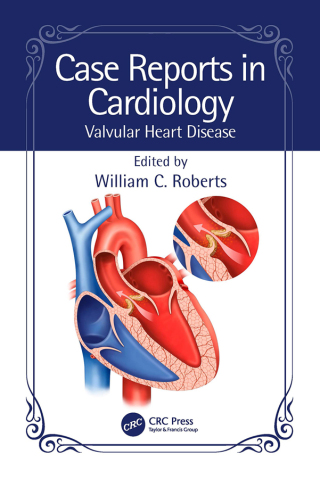 表紙画像: Case Reports in Cardiology 1st edition 9781032529363