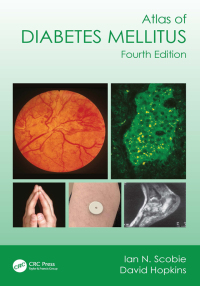 Cover image: Atlas of Diabetes Mellitus 4th edition 9781032379463