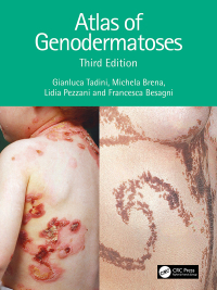 Cover image: Atlas of Genodermatoses 3rd edition 9780367643966