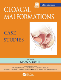 Cover image: Cloacal Malformations: Case Studies 1st edition 9781032230535