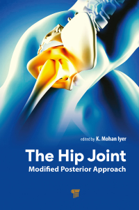 Titelbild: The Hip Joint 1st edition 9789815129021