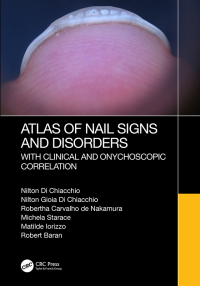 表紙画像: Atlas of Nail Signs and Disorders with Clinical and Onychoscopic Correlation 1st edition 9781032257907