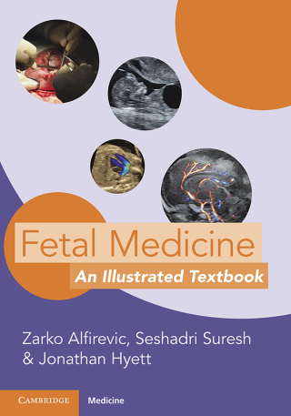 Cover image: Fetal Medicine 9781009015943