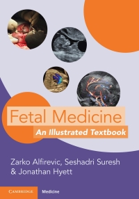 Imagen de portada: Fetal Medicine 9781009015943