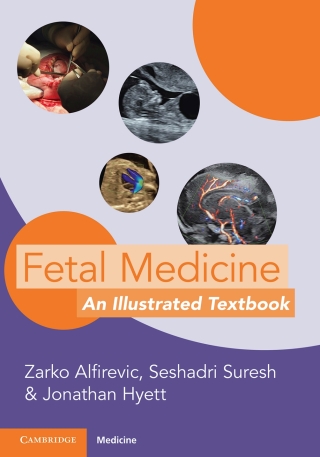 Cover image: Fetal Medicine 9781009015943