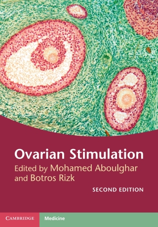 Imagen de portada: Ovarian Stimulation 2nd edition 9781107135970