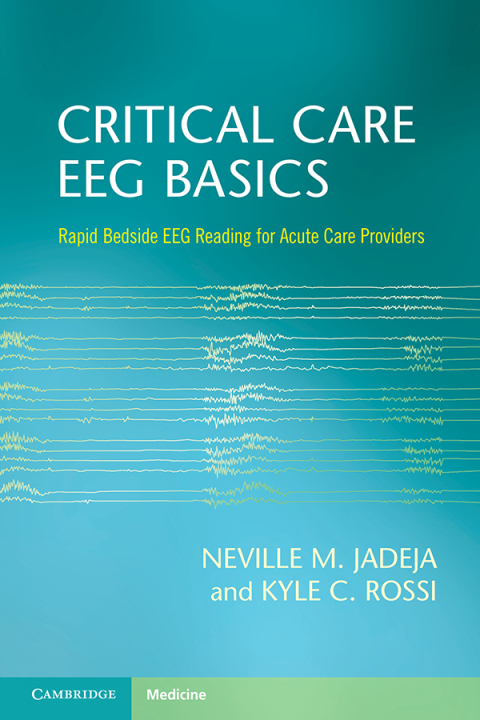 Critical Care EEG Basics: Rapid Bedside EEG Reading for Acute Care Providers - FULL INSTANT DOWNLOAD | PDF DOCX EPUB