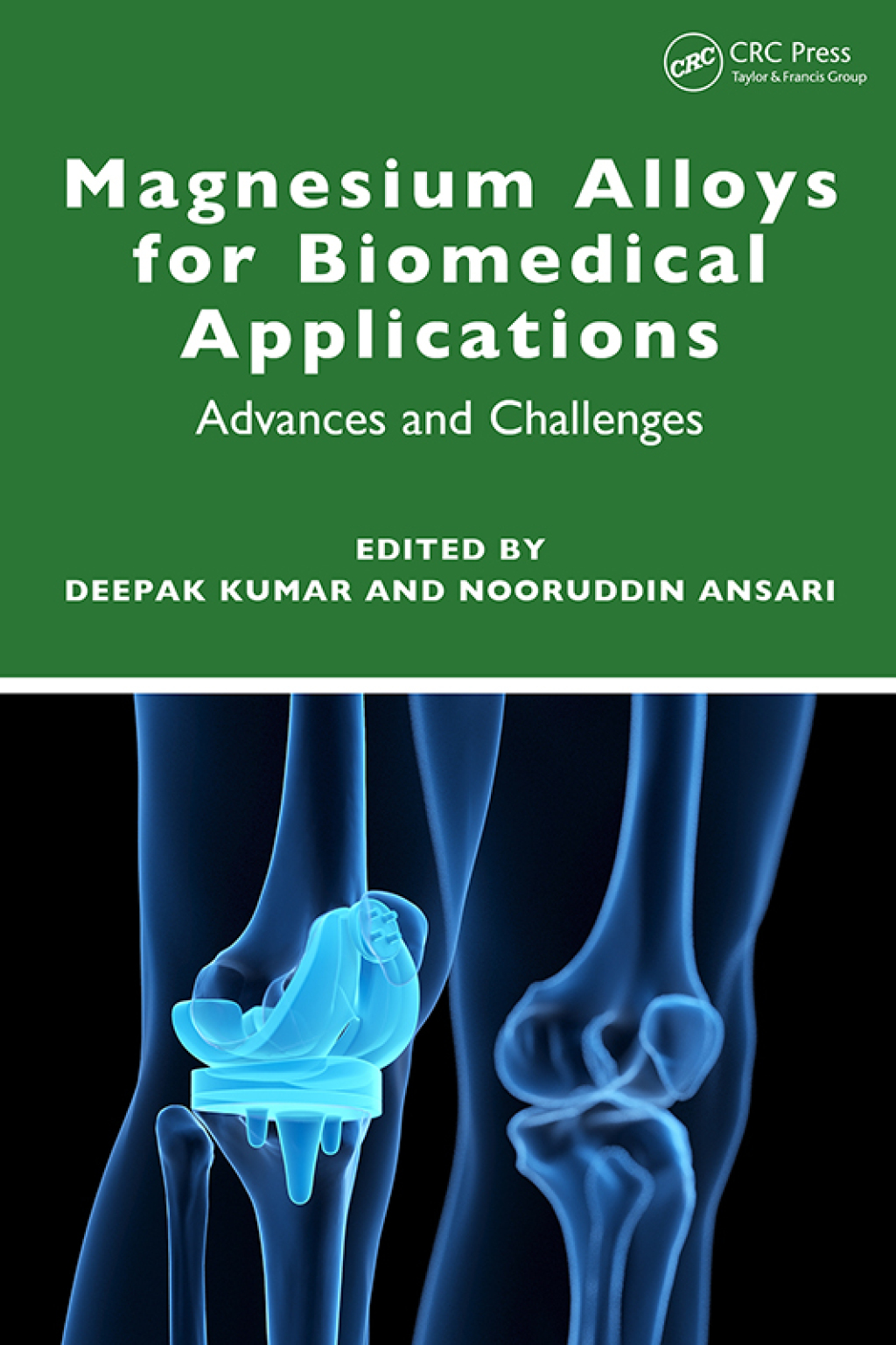 Magnesium Alloys for Biomedical Applications Advances and Challenges 1st Edition
