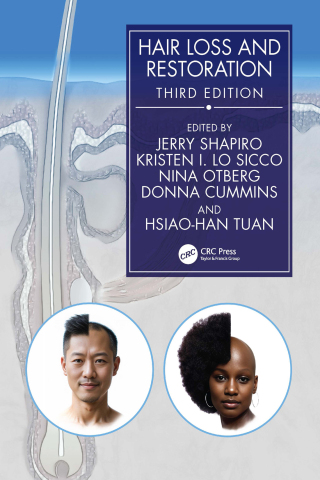 Cover image: Hair Loss and Restoration 3rd edition 9781032909042