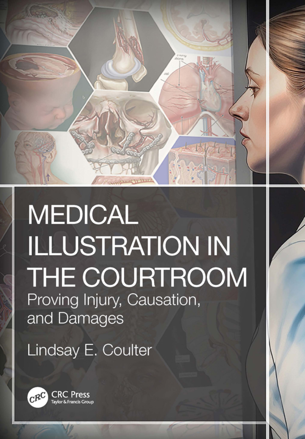 Medical Illustration in the Courtroom Proving Injury, Causation, and Damages 1st Edition