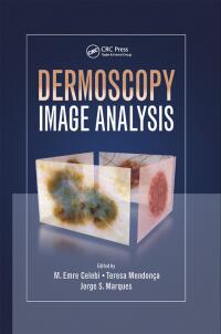Cover image: Dermoscopy Image Analysis 1st edition 9781482253269