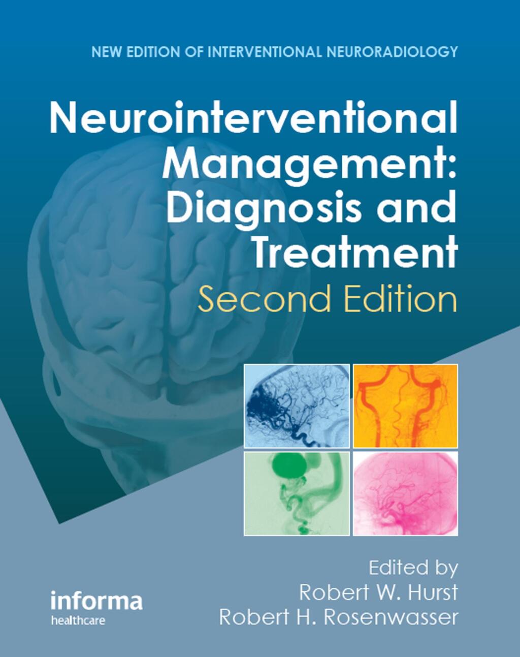 Neurointerventional Management Diagnosis and Treatment 2nd Edition