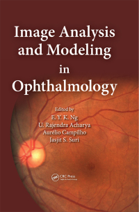 Cover image: Image Analysis and Modeling in Ophthalmology 1st edition 9781466559301