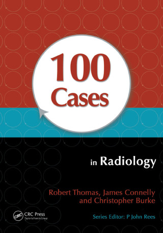 Cover image: 100 Cases in Radiology 1st edition 9781444123319