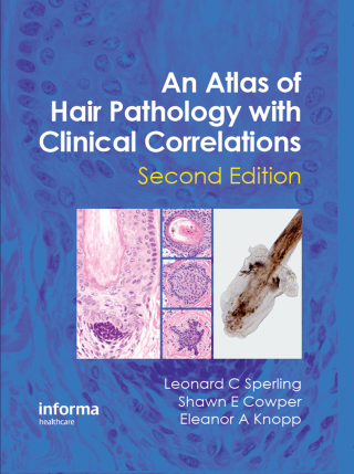 Cover image: An Atlas of Hair Pathology with Clinical Correlations 2nd edition 9781841847337