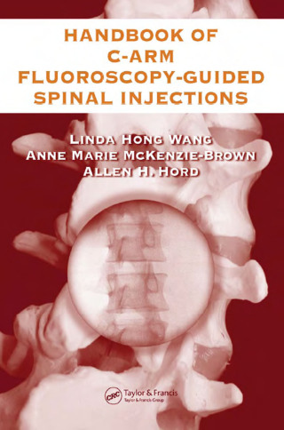 Cover image: The Handbook of C-Arm Fluoroscopy-Guided Spinal Injections 1st edition 9780849322549