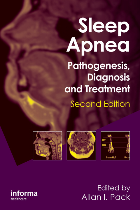 Sleep Apnea: Pathogenesis, Diagnosis and Treatment, 2nd Edition - FULL INSTANT DOWNLOAD | PDF DOCX EPUB