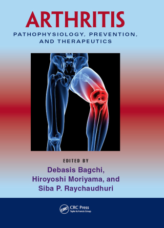 Imagen de portada: Arthritis 1st edition 9781439816868