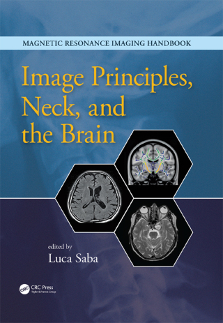 Cover image: Image Principles, Neck, and the Brain 1st edition 9781482216134