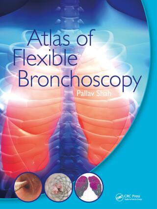 Cover image: Atlas of Flexible Bronchoscopy 1st edition 9781032477589
