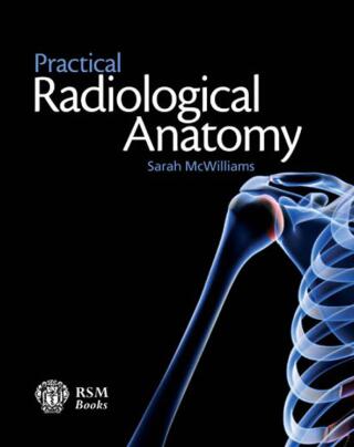 Cover image: Practical Radiological Anatomy 1st edition 9781853158001