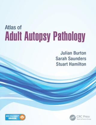 Cover image: Atlas of Adult Autopsy Pathology 1st edition 9781444137521