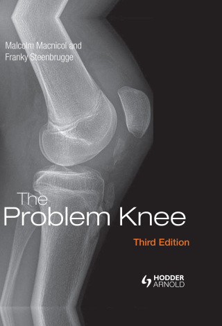 Omslagafbeelding: The Problem Knee 3rd edition 9781138372467