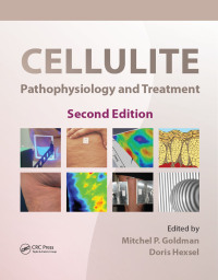 Cover image: Cellulite 2nd edition 9781841847887