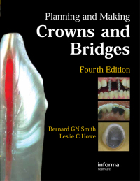 صورة الغلاف: Planning and Making Crowns and Bridges 4th edition 9780415398503