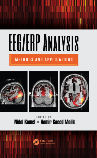 Cover image: EEG/ERP Analysis 1st edition 9781482224696