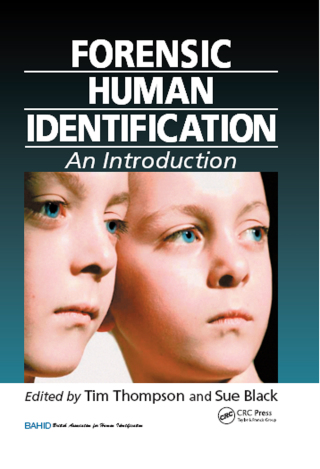 Cover image: Forensic Human Identification 1st edition 9780849339547