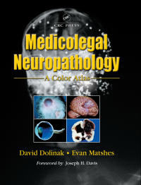 Cover image: Medicolegal Neuropathology 1st edition 9780849313615