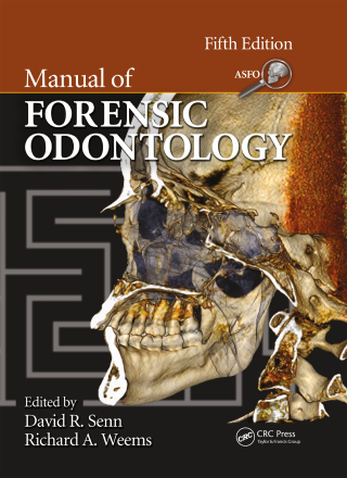 Cover image: Manual of Forensic Odontology 5th edition 9781439851333