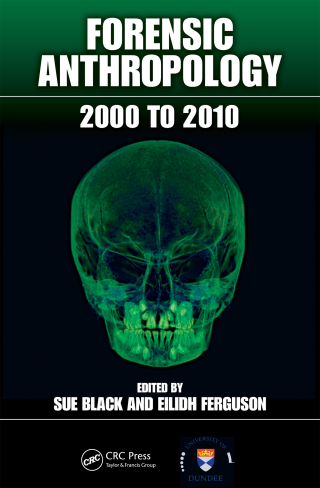 Cover image: Forensic Anthropology 1st edition 9781439845882