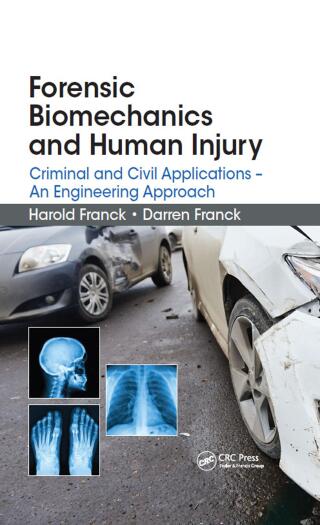 Cover image: Forensic Biomechanics and Human Injury 1st edition 9781482258837